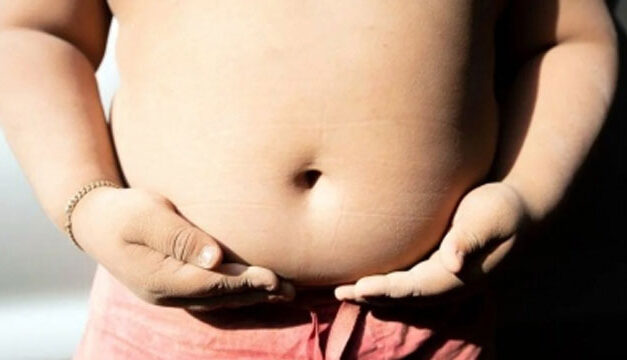 Adolescent Obesity Linked to Increase in Abdominal Fibrogenesis: Study