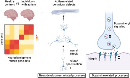 Novel Therapeutic Target Identified to Transform Autism Treatment