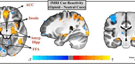 Yoga based intervention can reduce opioid dependence