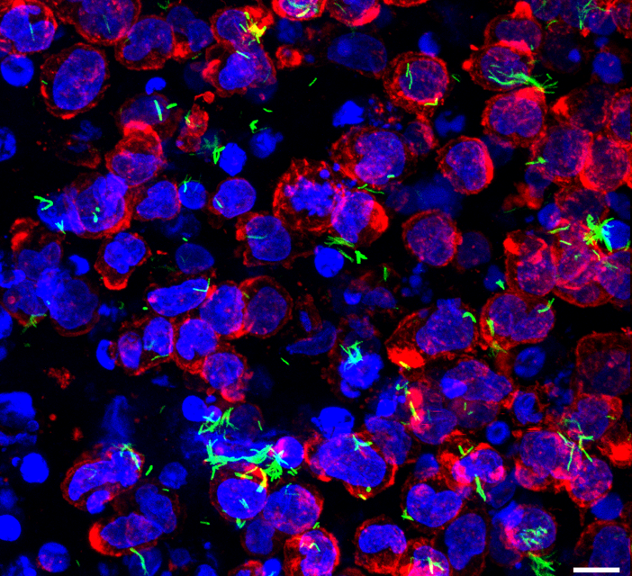 Novel 3D hydrogel culture to study TB infection and treatment