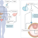 Study Finds Dramatic Increase in Ovarian Cancer Risk for Those with Severe Endometriosis