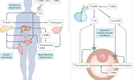 Antimalarial Drug Shows Promise in Treating Polycystic Ovarian Syndrome