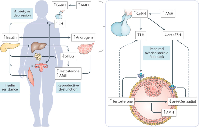 New Study Identifies Key Trigger in Deadly Ovarian Cancer