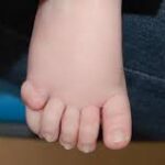 Delhi’s ANMOL Scheme Aims to Revolutionize Newborn Screening and ICU Access