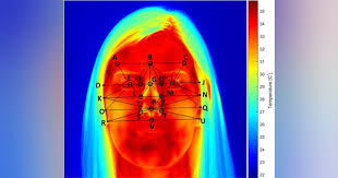 Doctors Could Soon Use Facial Temperature for Early Diagnosis of Metabolic Diseases