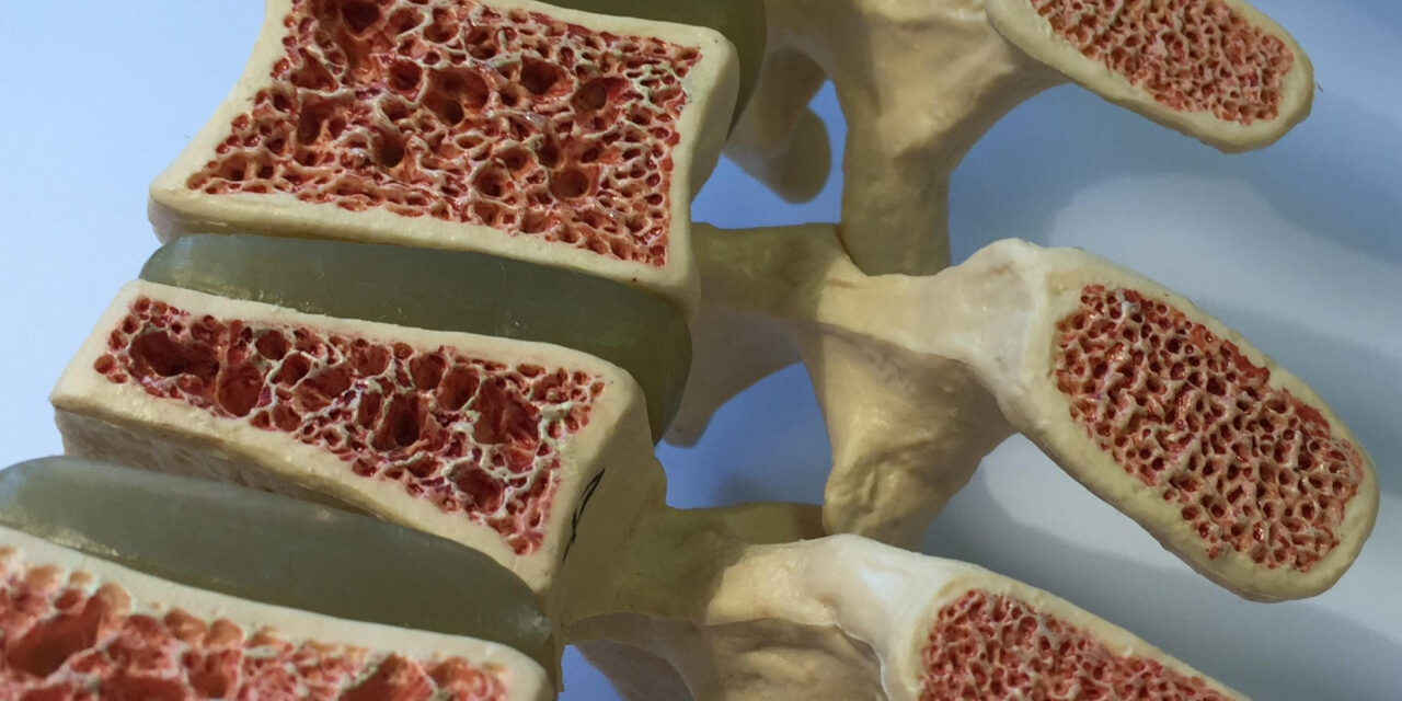 Harvard Scientists Debunk Popular Myth About Aging Bones, Shifting Focus in Osteoporosis Treatment