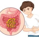 Study Reveals How Certain E. coli Bacteria Contribute to Colon Cancer Development