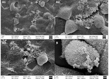 New strain of lactic acid bacterium could be promising probiotic for food and pharmaceutical industry