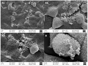 New strain of lactic acid bacterium could be promising probiotic for food and pharmaceutical industry