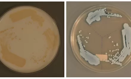 Unraveling the Spread of Candida auris: A Global Health Threat