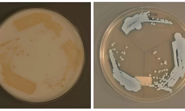 The “Silent Surge”: Global Experts Unveil 5-Step Strategy to Combat Drug-Resistant Fungi
