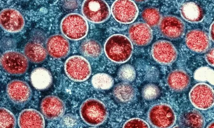 Smallpox Vaccination in Childhood May Offer Protection Against Monkeypox Clade II Viruses, Study Finds