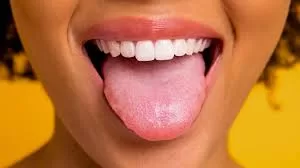 New AI Algorithm Predicts Diabetes and Stroke with 98% Accuracy by Analyzing Tongue Color