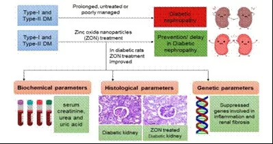 New Research on Zinc Oxide Nanoparticles Offers Hope for Millions of Diabetic Patients