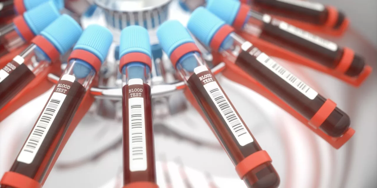 Lipid Tests Revolutionize Childhood Disease Prediction: New Study from King’s College London