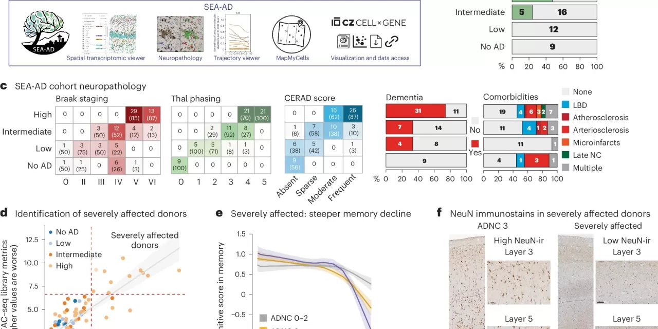 New Study Redefines Alzheimer’s Progression into Two Distinct Phases