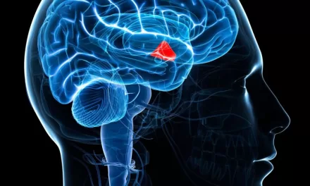 Clot-Busting Medication and Mechanical Retrieval Show Similar Results in Reducing Disability from Some Strokes