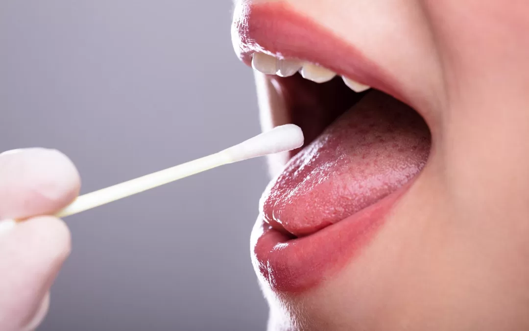 Portable Tongue‑Swab TB Test Shows High Accuracy in India, Could Speed Up Diagnosis