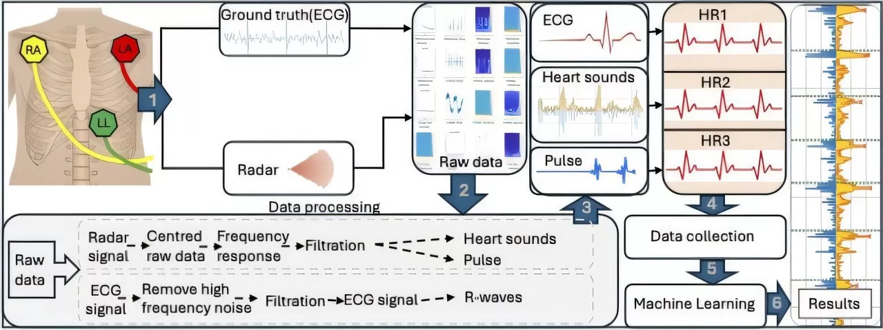 University of Glasgow Researchers Develop Groundbreaking ‘Radar Stethoscope’ for Contactless Heart Monitoring