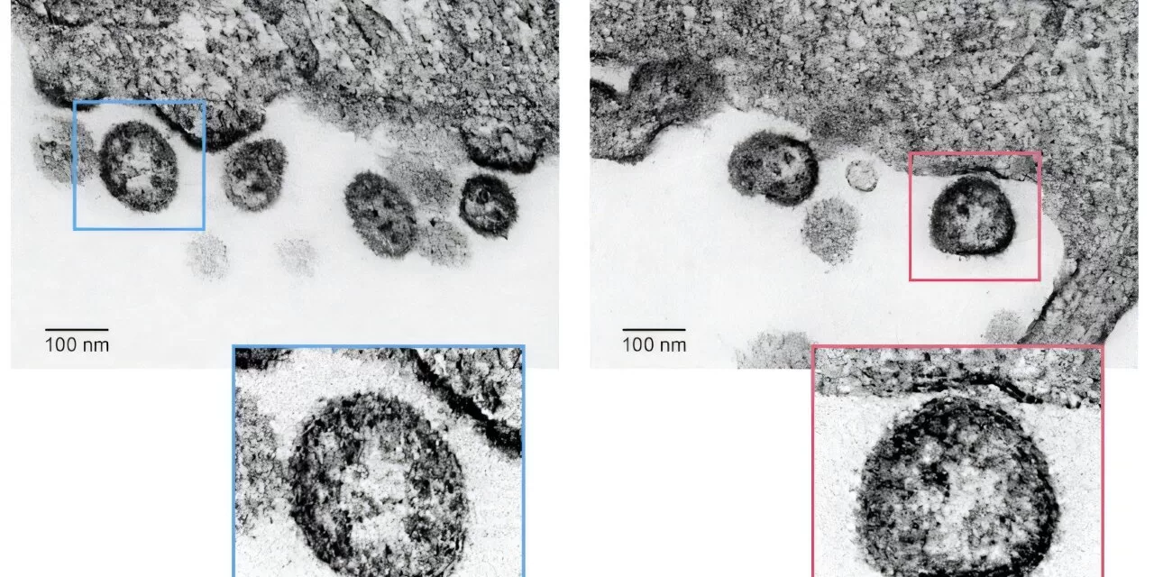 Promising New Live-Attenuated Vaccine Shows Success Against Lassa Virus