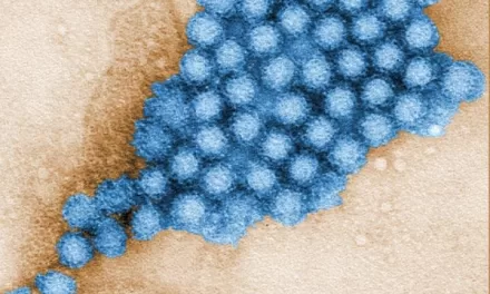 Surge in Norovirus Cases in the US: Why Winter Makes It Worse and How to Protect Yourself