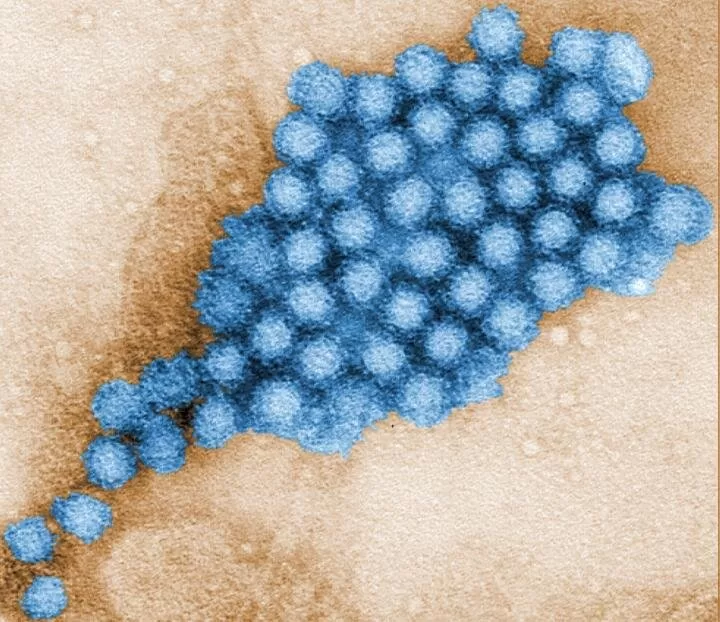 Discovery of Norovirus Replication Hubs Could Lead to New Antiviral Targets