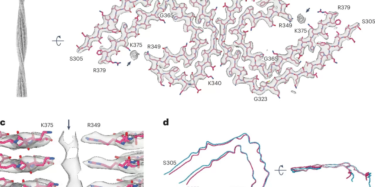 New Study Sheds Light on Tau Filaments and Extracellular Vesicles in Alzheimer’s Disease