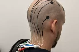 Temporary Tattoo Offers a Hair-Friendly Solution for Monitoring Brain Activity