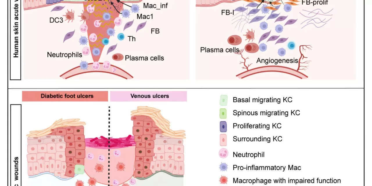 New Study Sheds Light on How Cells Coordinate to Heal Human Wounds