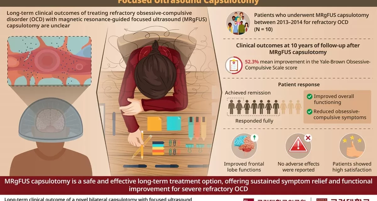 Revolutionary Ultrasound Surgery Offers Long-Term Relief From Severe OCD