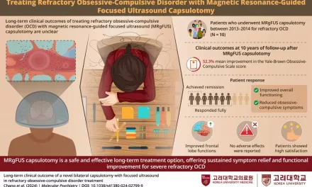 Revolutionary Ultrasound Surgery Offers Long-Term Relief From Severe OCD