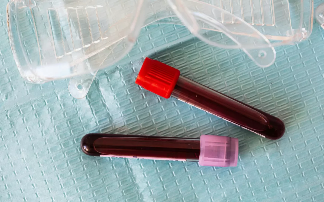 Your Blood Test Just Got More Personal: New Screen Reveals the Biological Age of Your Organs, Spotlighting Brain Health