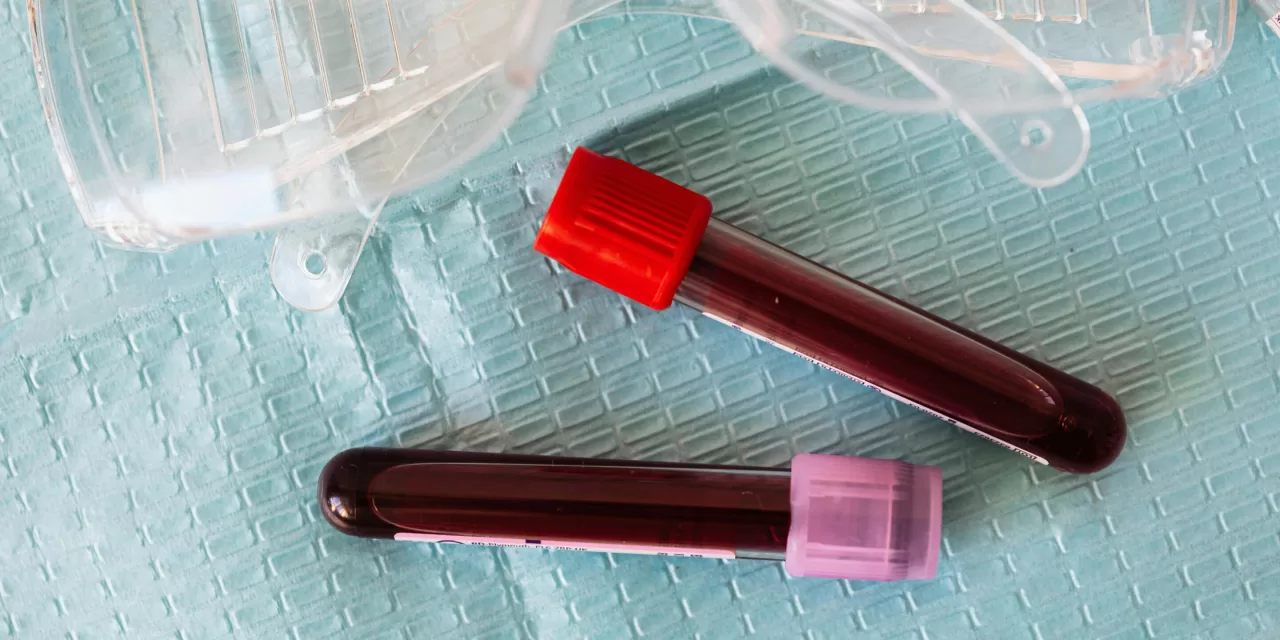 Galleri Blood Test: A Revolutionary Step in Early Cancer Detection