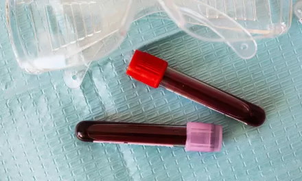 New Blood Test Shows Promising Results for Detecting Colon Cancer