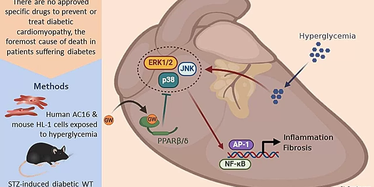 Study Identifies New Target for Diabetic Heart Disease Therapy