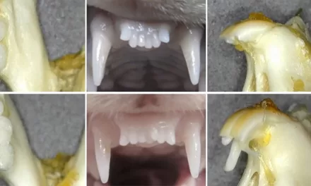 Japanese Researchers Test Pioneering Drug to Regrow Teeth