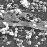 Florida Reports First Vibrio vulnificus Death of 2026: What Coastal Residents and Seafood Consumers Need to Know