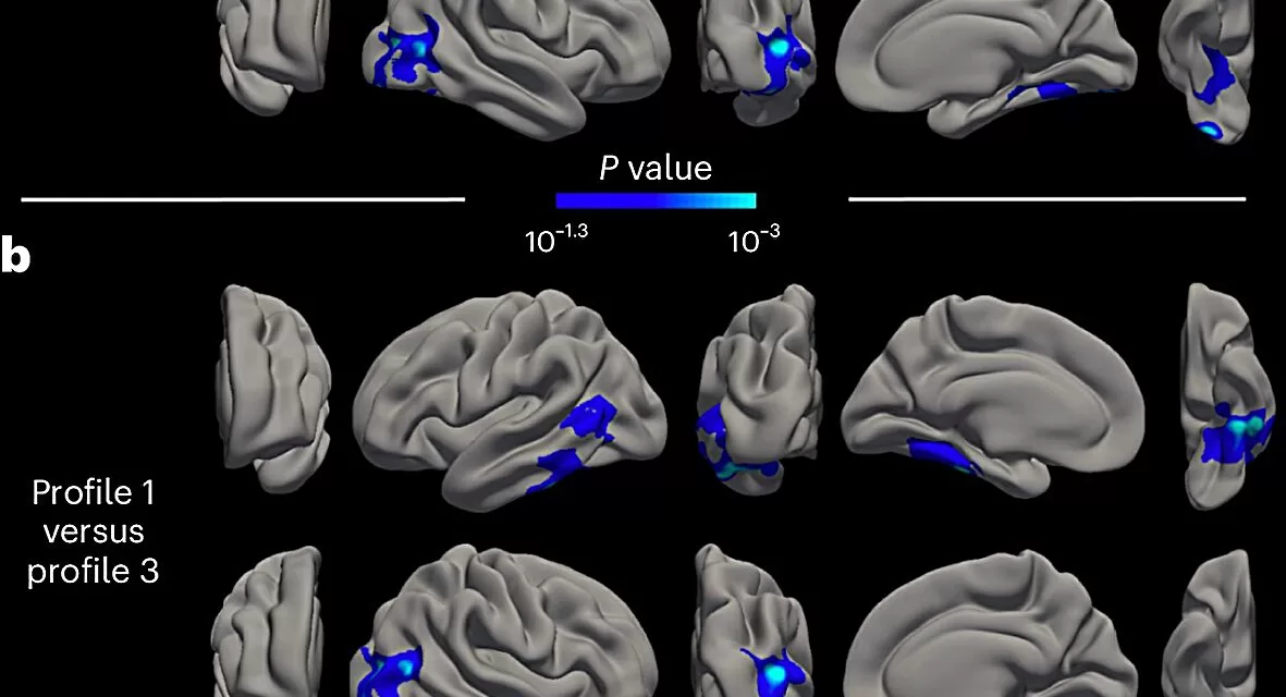 Three Psychological Profiles Could Determine the Evolution of Mental, Cognitive, and Brain Health in Aging