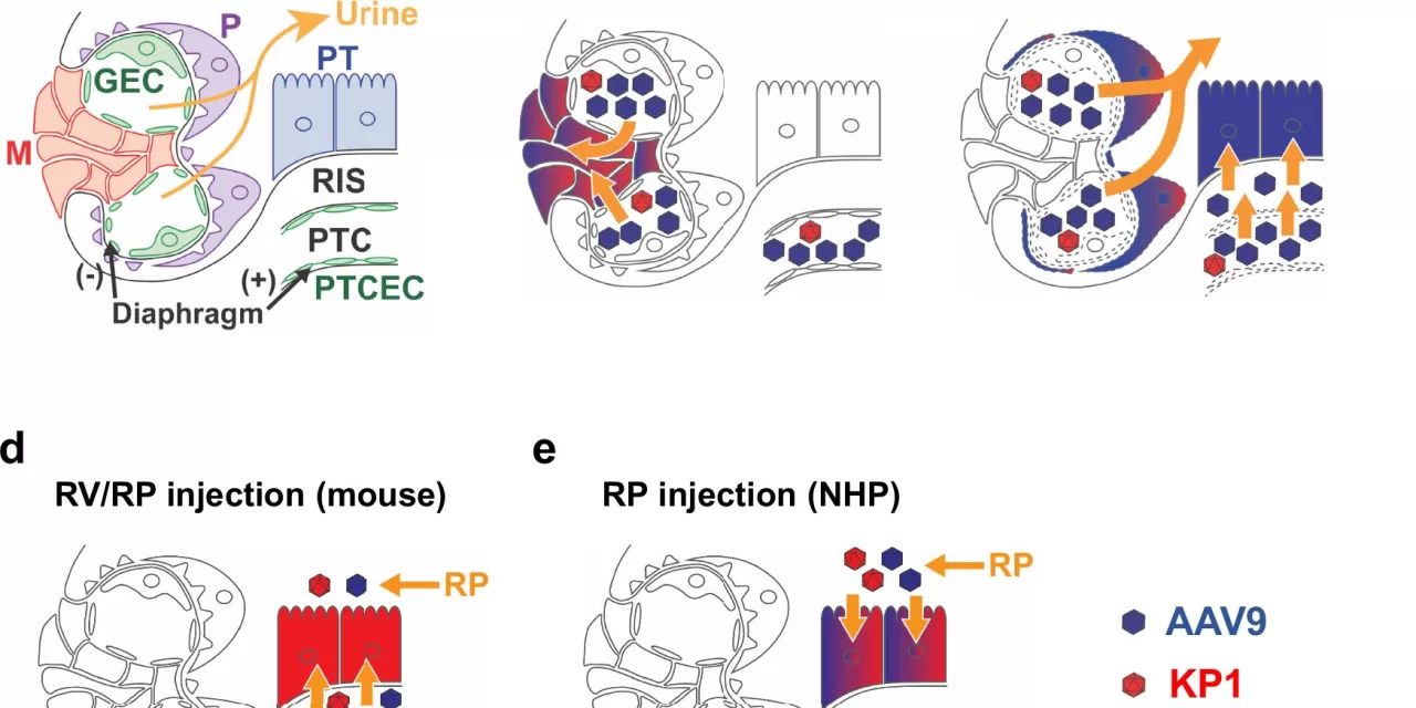 Gene Therapy Research Offers New Hope for Chronic Kidney Disease Patients