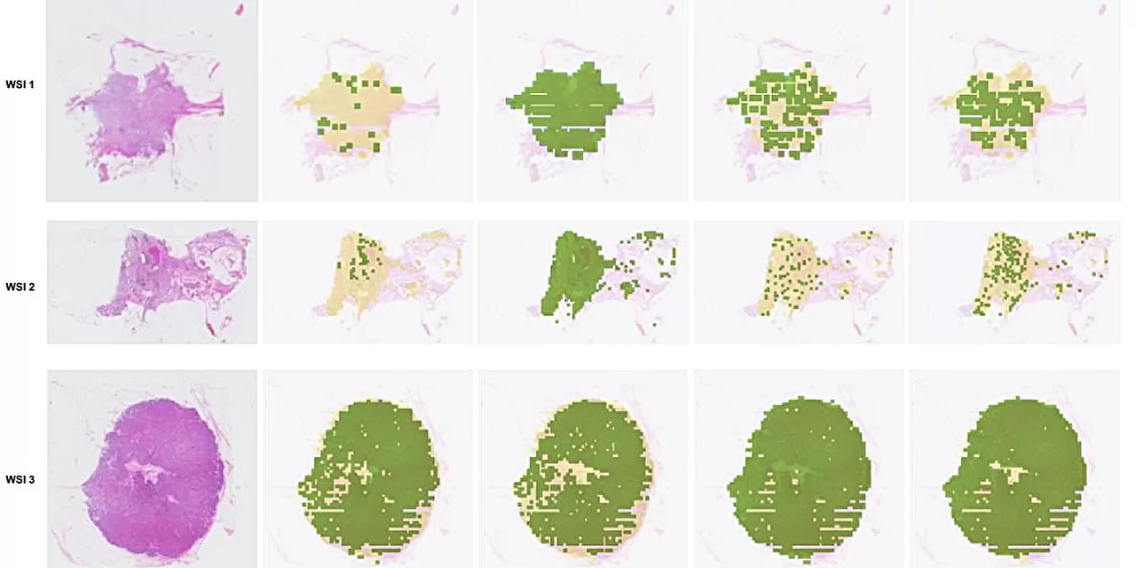 Advancements in AI for Breast Cancer Diagnosis: Abhinav Sharma’s Groundbreaking Thesis on Deep Learning-Based Models