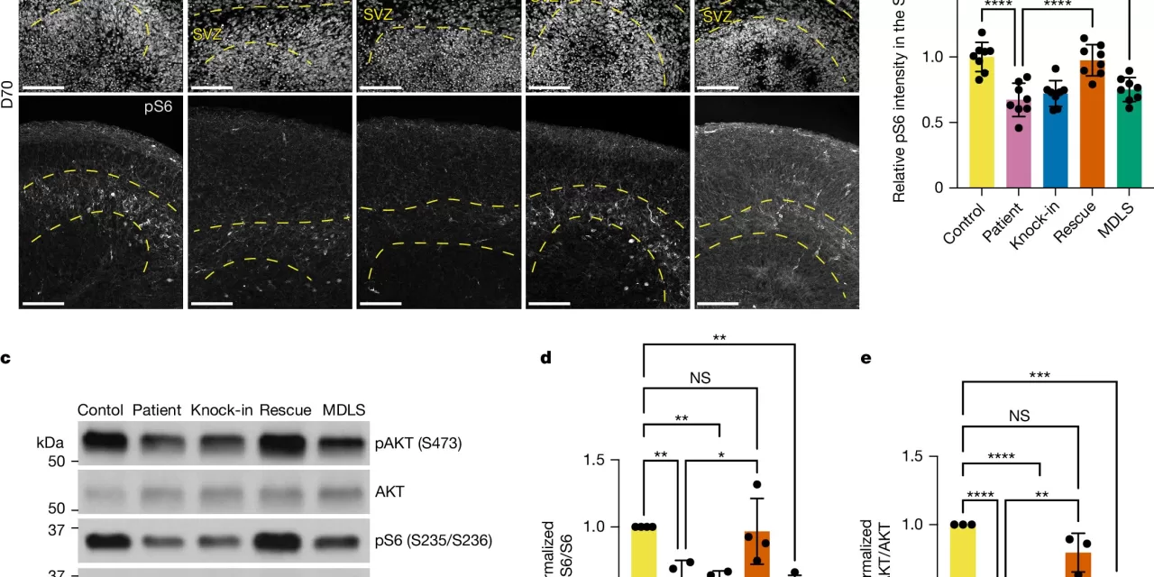 Potential Treatment for “Smooth Brain” Disorders Identified in New Study