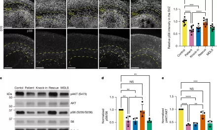 Potential Treatment for “Smooth Brain” Disorders Identified in New Study