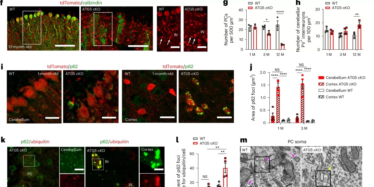 Powering Brain Health: How Autophagy Protects Neurons by Regulating Glucose Consumption