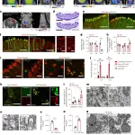 Powering Brain Health: How Autophagy Protects Neurons by Regulating Glucose Consumption