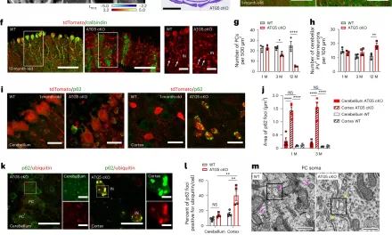 Powering Brain Health: How Autophagy Protects Neurons by Regulating Glucose Consumption