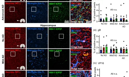 Herpes Virus May Drive Alzheimer’s Pathology, New Study Suggests