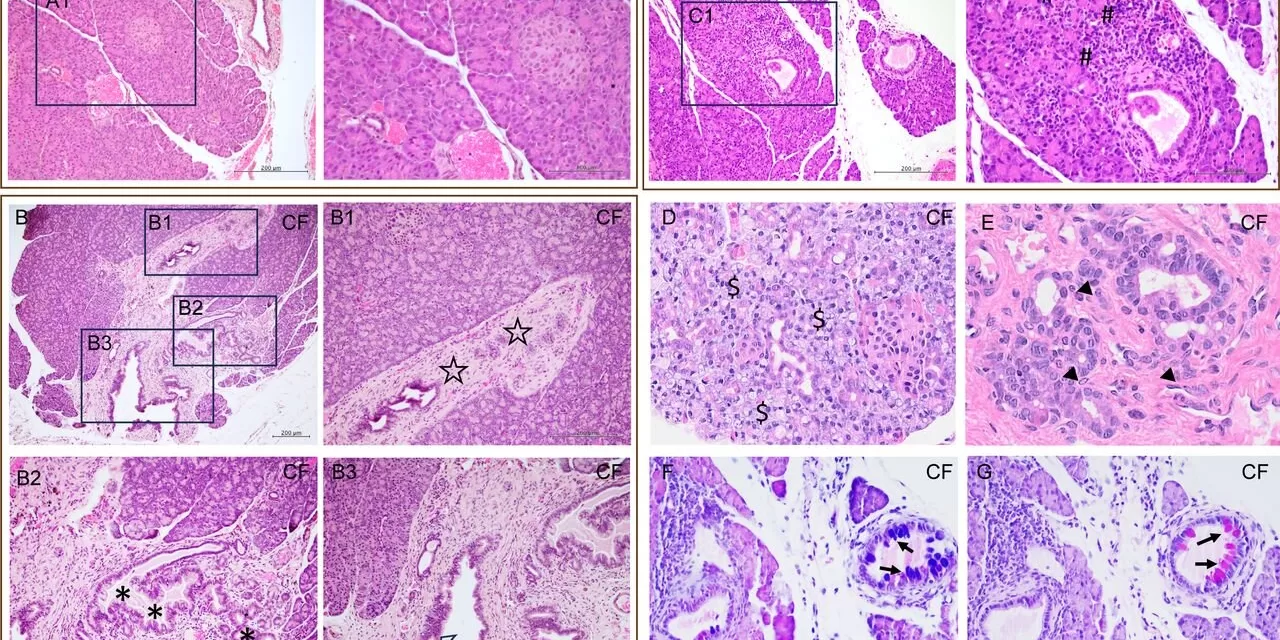 New Animal Model Sheds Light on Pancreatic Disease and Diabetes in Cystic Fibrosis