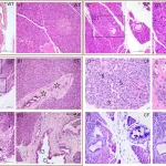 New Animal Model Sheds Light on Pancreatic Disease and Diabetes in Cystic Fibrosis