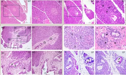 New Animal Model Sheds Light on Pancreatic Disease and Diabetes in Cystic Fibrosis