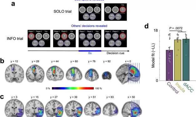 Brain Takes the Easy Route by Following the Crowd in Uncertain Situations